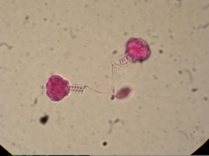 zooplankton1